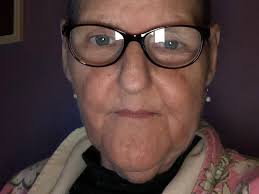 Fundraiser by Carol Burke : Annie needs help.