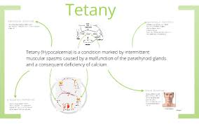 Image result for Tetany