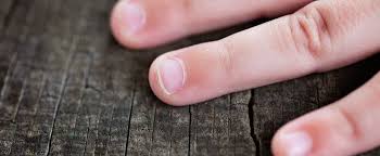 Weisse Flecken Auf Den Fingernageln Hier 3 Ursachen Erfahren