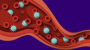 Image result for Sepsis