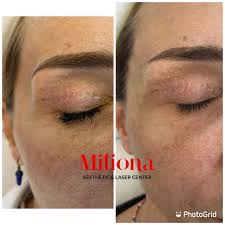 Maybe you would like to learn more about one of these? Miliona Aesthetic Added A New Photo Miliona Aesthetic