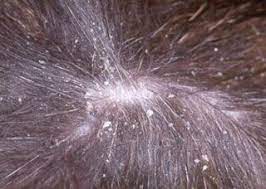 If the dandruff is severe, then you should bathe your pet every other day for a week or even 10 days. Walking Dandruff In Dogs Dog Dandruff Dandruff Causes Cat Dandruff Remedy