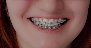 Maybe you would like to learn more about one of these? Dentist Port Elizabeth Dr M Essack Smile Hub