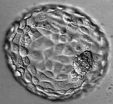 Pin On Infertility Struggle