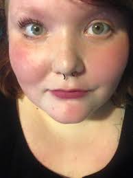 Okay can I see all the before and after pics im just very nervous