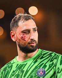 𝗟𝗮 𝗿𝗮𝗶𝘀𝗼𝗻 𝗽𝗼𝘂𝗿 𝗹𝗮𝗾𝘂𝗲𝗹𝗹𝗲 𝗟𝗲𝘁𝗲𝘅𝗶𝗲𝗿 𝗻'𝗮 𝗽𝗮𝘀  𝘀𝗼𝗿𝘁𝗶 𝗱𝗲 𝗰𝗮𝗿𝘁𝗼𝗻 𝗮𝗽𝗿𝗲̀𝘀 𝗹𝗮 𝗯𝗹𝗲𝘀𝘀𝘂𝗿𝗲 𝗱𝗲  𝗗𝗼𝗻𝗻𝗮𝗿𝘂𝗺𝗺𝗮 ! Alors qu'il avait exclu Amine Harit pour un pied  haut face à Marquinhos lors d'un précédent