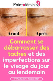 Un Dermatologue Celebre Revele Comment Eliminer Les Taches Brunes Sur Le Visage Et La Peau Avec Une Astuce Sipmle Peau Beaute Visage R Health Movie Posters