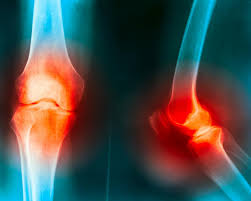 Many types of knee injuries can occur. The Knee Anatomy Injuries Treatment And Rehabilitation