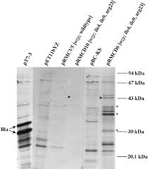 Share the best gifs now >>>. Overexpression And Topology Of The Shigella Flexneri O Antigen Polymerase Rfc Wzy Daniels 1998 Molecular Microbiology Wiley Online Library
