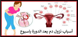 atvasinasana naids izdilis سبب نزول دم بعد الدوره ipoor org