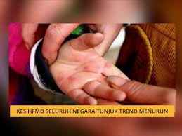 Kandungan polevenoland dan flavonoid yang dimiliki daun sirih dapat menjadi antioksidan, antiseptik serta antiinflamasi. Kaki Dan Mulut Berita Terkini Foto Video Mengenai Kaki Dan Mulut Astro Awani