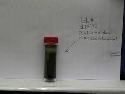 Feb 27, 2008 · testing for water bacteria. Water Research Center Water Testing Total Coliform Fecal Bacteria Pathogenic Organisms In Drinking Water