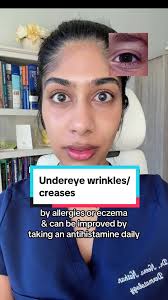 Get Rid of Dennie-Morgan Lines: Treat Under Eye Wrinkles and Creases