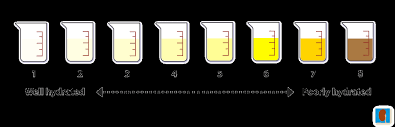 Image result for Urine Output