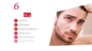 6 Common Causes Of Hair Loss In Men Healthy Essentials