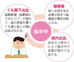 {{ login_id.substr(0, 30) }}{{ login_id.length > 30 ? è„³å'ä¸­ã¨ã¯ è„³å'ä¸­ã‚»ãƒ³ã‚¿ãƒ¼ è±Šä¸­å¸‚