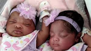 Woman gives birth to twins while in a coma due to coronavirus