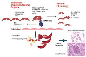 Image result for Plasmic Score