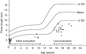 A yongnuo speedlight at left of the camera. Penis Length Cm In Patients With 46 Xy Idiopathic Disorder Of Sex Download Scientific Diagram