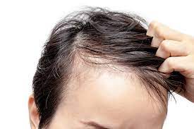 Hairstyles that work for your texture. Tips For Selecting The Right Shampoo For Thin Hair Petal Fresh