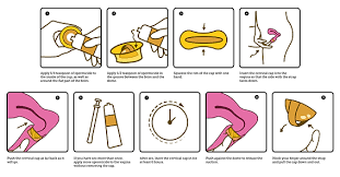 Image result for Cervical Cap