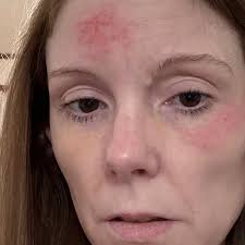 Fundraiser by Amy Jump : Support for Amy's medical procedures and housing.