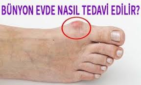 Bilgiler Panosundaki Pin