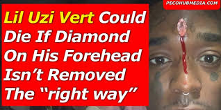 Lil uzi vert diamond blood. Lil Uzi Vert Could Die If Diamond On His Forehead Isn T Removed The Right Way Celebrities Nigeria