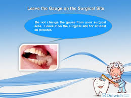 Get your free medicare plus card for up to 75% discount on your dental care. Recovery After Wisdom Teeth Removal Surgery