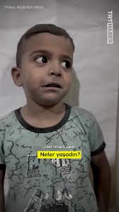 Bu gözler insanlık suçunu gördü. Küçücük bir 'mazlumun' titreyen bedeni  anlattı vahşeti... #i̇srail’in hastane katliamından yaralı kurtulan  #Gazzeli #çocuk vicdanlara kazındı.