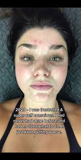 Lauren Oconnell Survivor Body Before and After