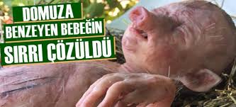 Domuza Benzeyen Bebegin Sirri Cozuldu