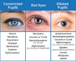 For a doctor to prescribe adderall as the first medication, there are specific symptoms a doctor screens patients for. What Drugs Cause Red Eyes And Dilated Pupils Sober College