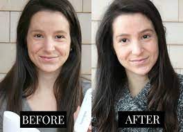 Neutrogena light therapy acne spot treatment. The Benefits Of Light Therapy For Acne Diary Of A Debutante