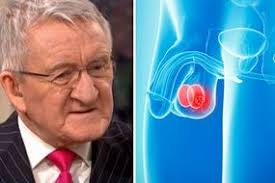 The nodes are connected by a network of lymphatic vessels. Testicular Cancer Symptoms The Unusual Sign In The Groin To Look Out For Express Co Uk