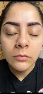 How to fix skin texture and pimples after changing skincare products?