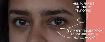 We did not find results for: Puffy Eyes Dark Circles And Bags Dermatologists Explain The Difference Self