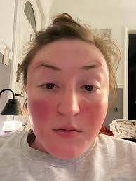 What supplements have caused your stomach to feel like it's burning? When I  add collagen powder to my smoothies my stomach feels like it's