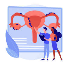 Endometriosis is the abnormal growth of endometrial cells outside the uterus. Endometritis And Endometriosis Two Different Causes Of Infertility Europe