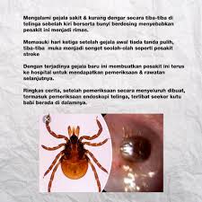 Kat bawah ni gambar dari google, tapi saya bayangkan posisi kutu babi tu macam ni la terbenam mesti kutu babi ni! Rpjltsqlfyrvpm