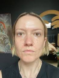 Oil based sunscreen recommendations for sensitive skin