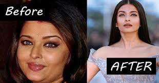 Much of the fat in your face is subcutaneous and naturally diminishes with age. How To Get Rid Of Cheek Fat In 10 Days