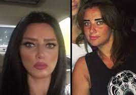 وقد اختلف العلماء في عمليات التجميل لهذا النوع من العيوب بناءً على أقوالهم في قطع الاصبع الزائدة إلى ما يلي: ØµÙˆØ± ØµØ§Ø¯Ù…Ø© Ù„Ø±Ø¶ÙˆÙ‰ Ø§Ù„Ø´Ø±Ø¨ÙŠÙ†ÙŠ Ù‚Ø¨Ù„ Ø¹Ù…Ù„ÙŠ Ø§Øª Ø§Ù„ØªØ¬Ù…ÙŠÙ„ Yasmina