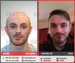 Sayın Andrew Clark Shepard'ın 12 aydaki sonucunu ve süreç boyunca  gelişimini sola kaydırarak görebilirsiniz.