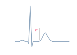 Image result for ST Segment