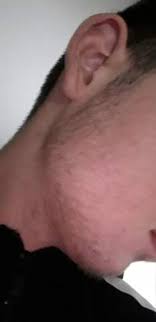 Während der pubertät führen männliche sexualhormone wie das testosteron bei jungen zu wachstumsschüben, prägen die sekundären. Mit 15 Bartwuchs Haare Manner Junge