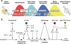 A Bone Fracture Healing Process Upon Bone Fracture Blood Vessels Download Scientific Diagram