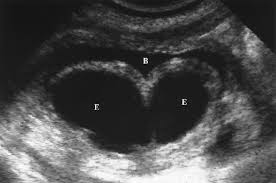 Pin On Abd 200 Mod 3 Ultrasound