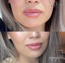 Modern Luxe Aesthetics LLC