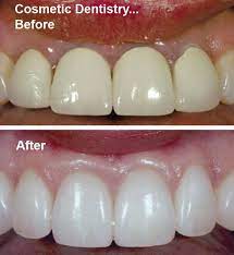 Pin On Cosmetic Dentistry In Delhi